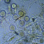 Descubren la &ldquo;c&aacute;psula de escape&rdquo; de las bacterias que podr&iacute;a ayudar a combatir las resistentes a los antibi&oacute;ticos
