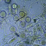 Descubren la “cápsula de escape” de las bacterias que podría ayudar a combatir las resistentes a los antibióticos