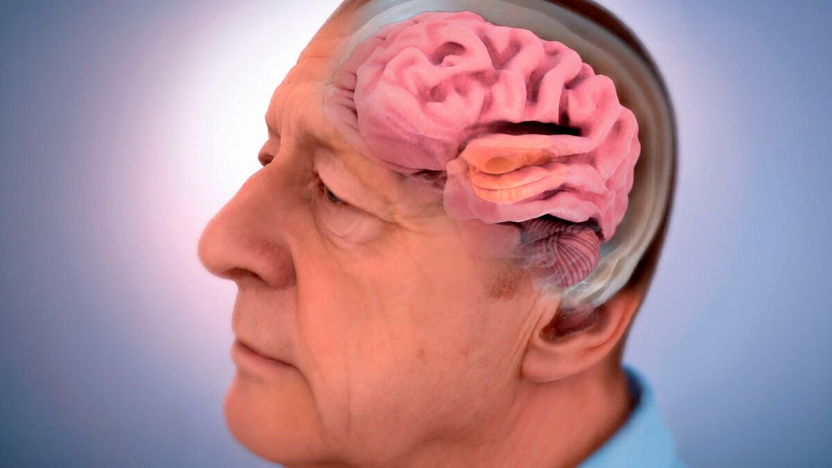 Brain defense cells decline after age 50, study finds