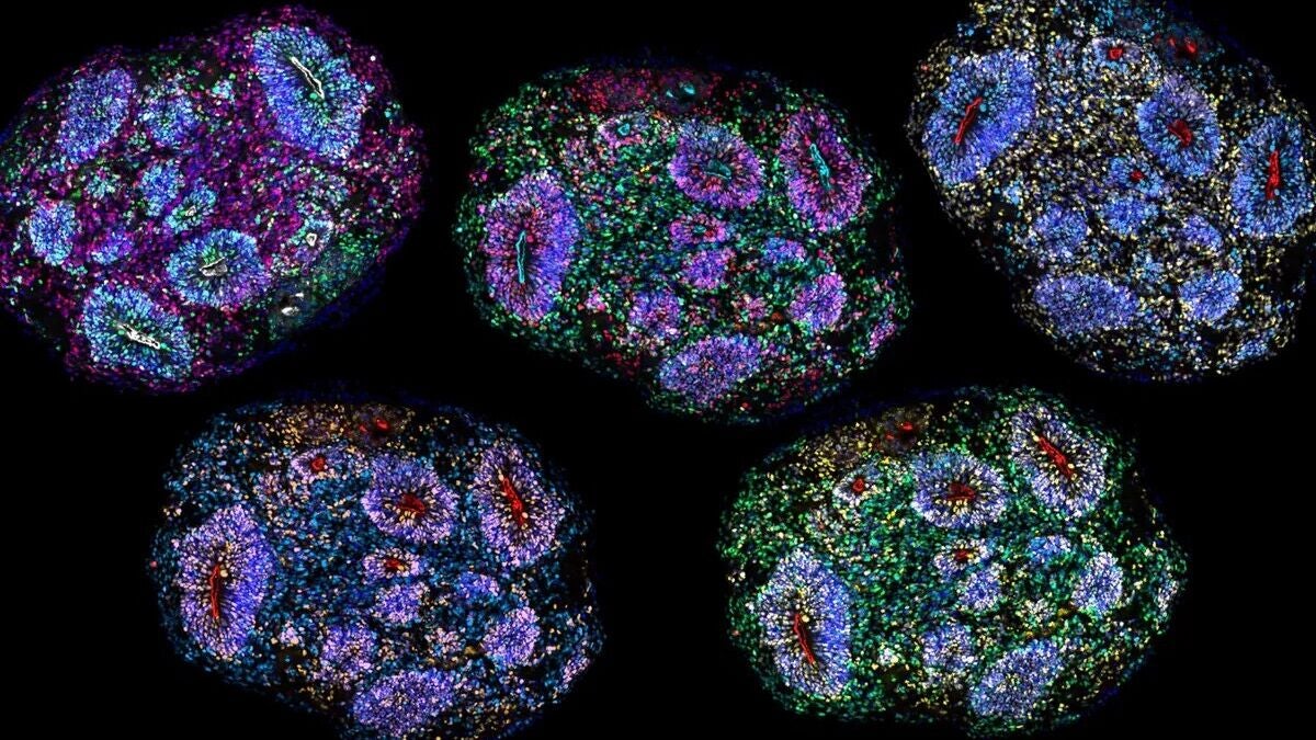 Human Brain Organoids Survive Six Years in Harvard Study