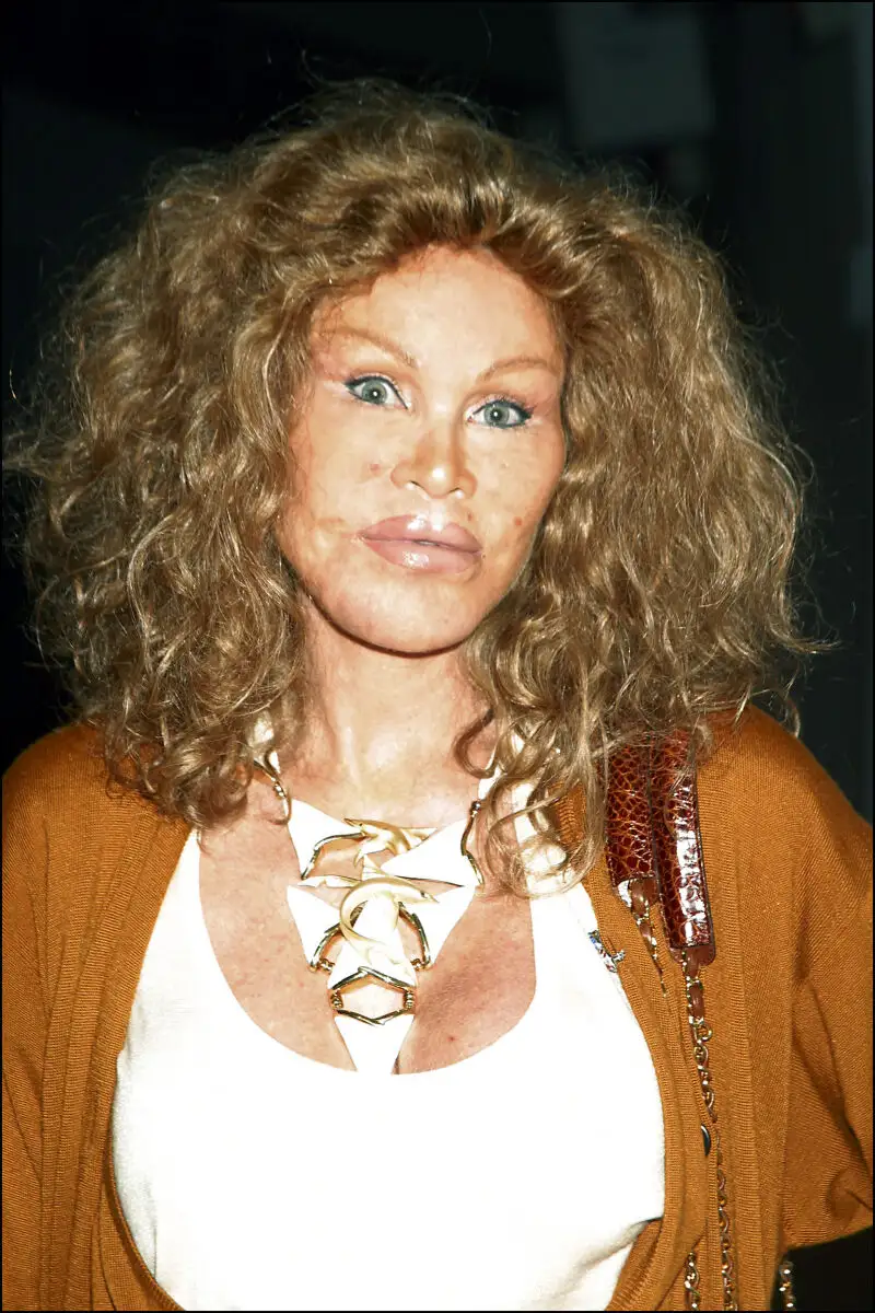 Jocelyn Wildenstein