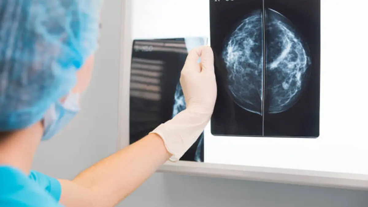 Científicos españoles identifican una vía para frenar la metástasis del cáncer de mama