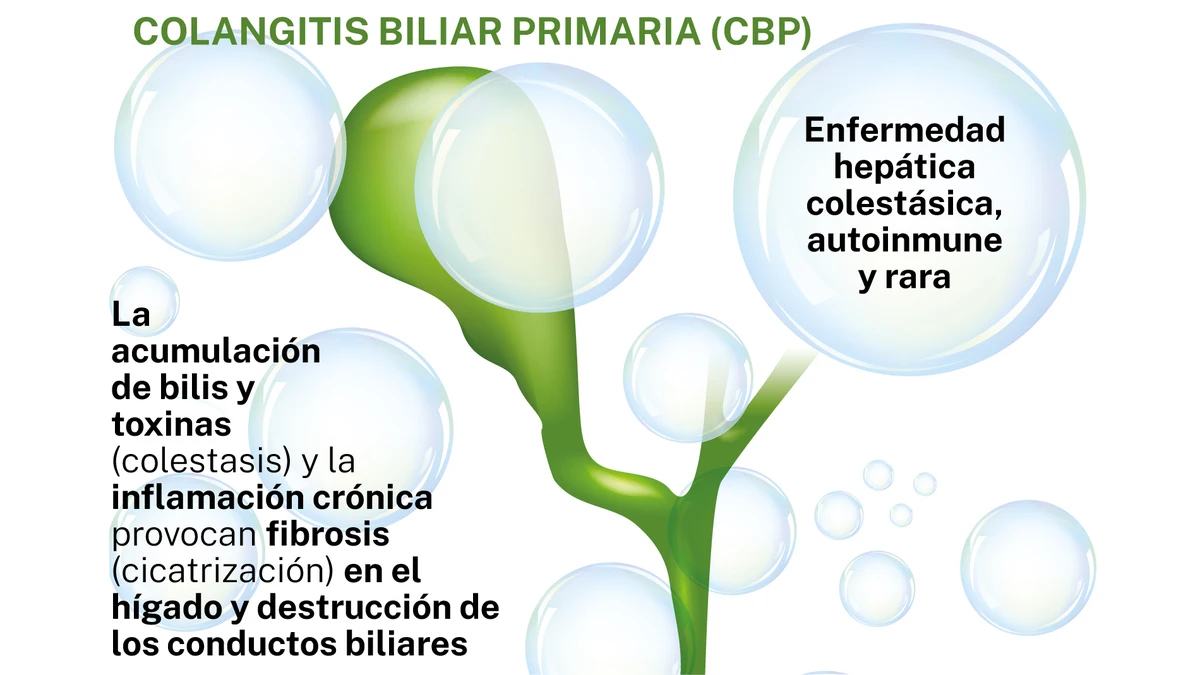 Colangitis biliar