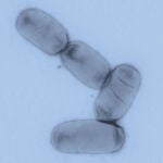 Salmonella enterica es uno de los principales patógenos entéricos tanto en países desarrollados como en regiones en vías de desarrollo.