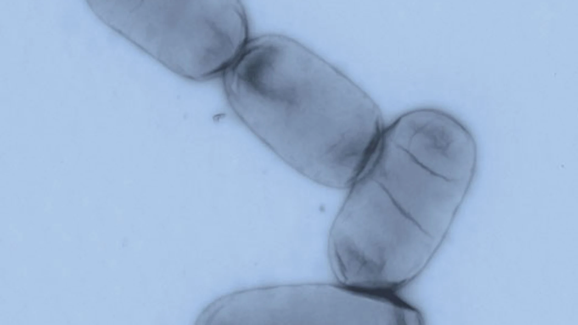 Salmonella enterica es uno de los principales patógenos entéricos tanto en países desarrollados como en regiones en vías de desarrollo.