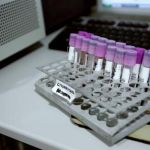 Cáncer de Colon