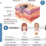 Cada año se diagnostican 60.000 nuevos casos de melanoma en Europa