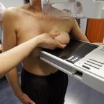 Una mujer se somete a una mamografía