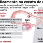 Los médicos alertan del riesgo de la píldora postcoital en mujeres obesas