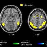 Las imágenes por resonancia magnética funcional han servido para detectar las zonas que se activaban en matemáticos y personas que no lo eran frante a enunciados matemáticos de alto nivel