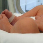 Avances en el mundo de los prematuros: la importancia del cuidado