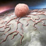  Cerco a un tumor cada vez más vulnerable