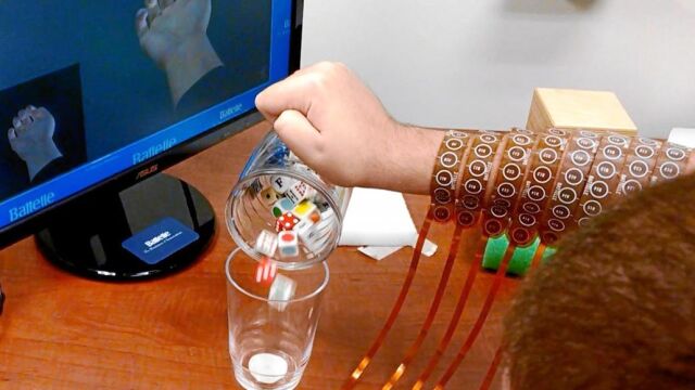 También ha podido verter el contenido de un frasco, gracias a los electrodos que conectan su cerebro y su brazo