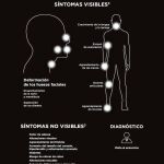 Acromegalia: La enfermedad de Shrek