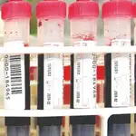 Predicciones en una gota se sangre