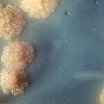 Colonias de Mycobacterium tuberculosis sobre un medio de cultivo.