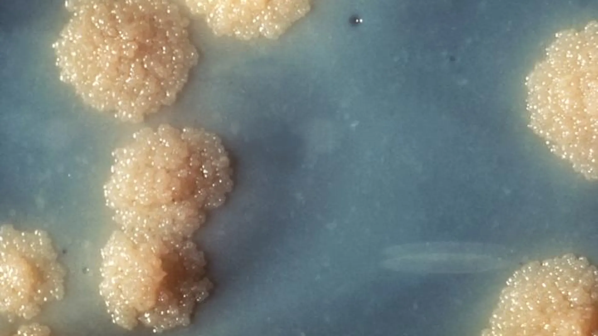 Colonias de Mycobacterium tuberculosis sobre un medio de cultivo.