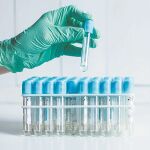 Los niños afectados hasta ahora han dado negativo para todos los virus que tipicamente causan hepatitis