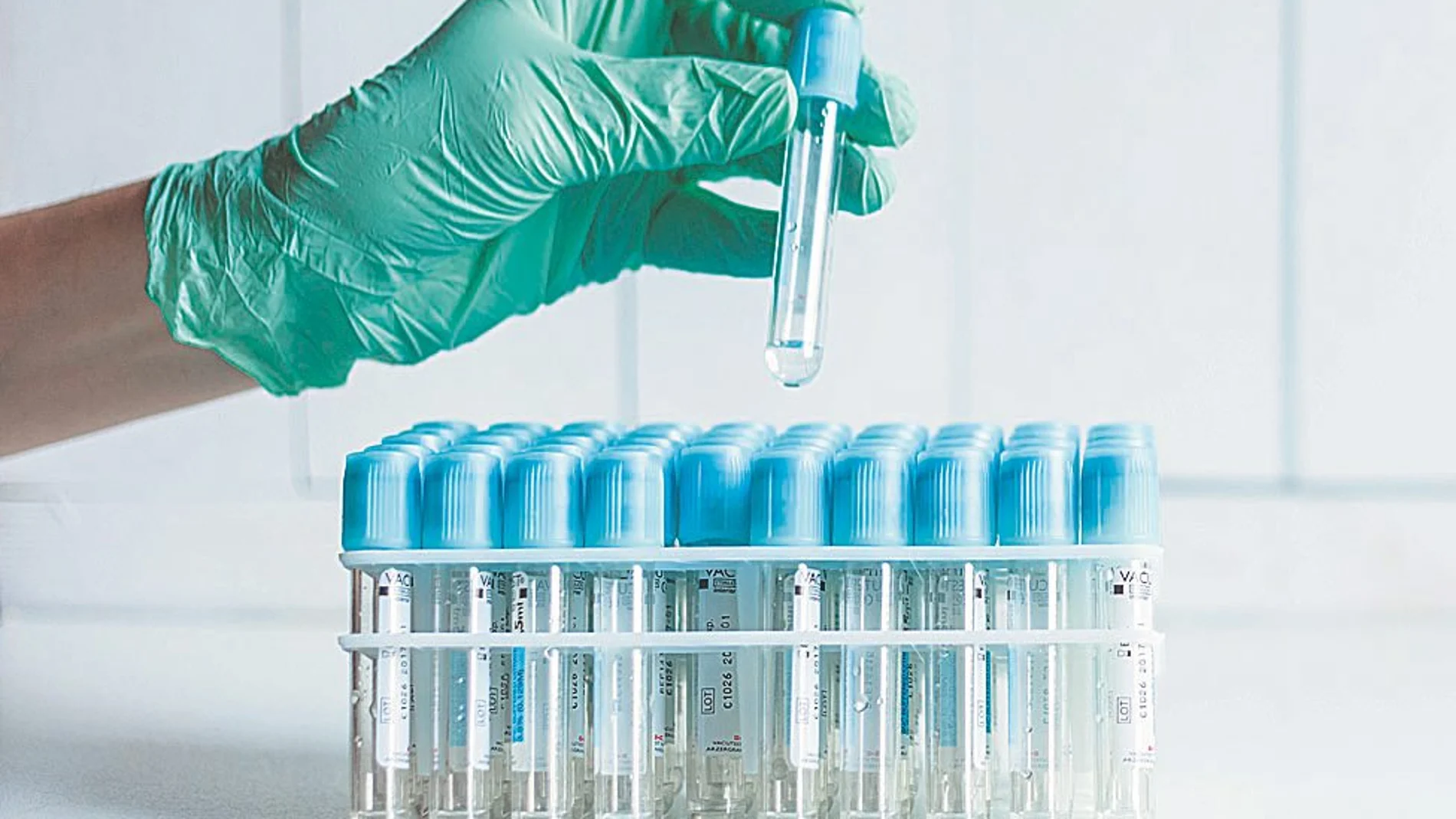 Los niños afectados hasta ahora han dado negativo para todos los virus que tipicamente causan hepatitis