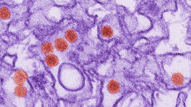 Virús del zika.