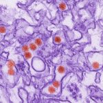 Virús del zika.