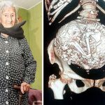 Estela de las Mercedes Meléndez Jiménez junto a la radiografía que confirma lo que ella ya sabía desde hace tiempo