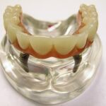 Dientes