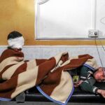 Dos de los menores sirios heridos en los últimos bombardeos se recuperan en un hospital de Mesraba, en Guta