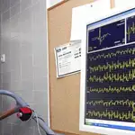 Cuando hablamos de una afección cardiaca, en la que los riesgos son -por definición- tan grandes, es de vital importancia que sea localizada cuanto antes | Fotografía de archivo