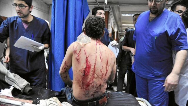 Un hombre sirio herido recibe primeros auxilios en un hospital de Damasco, donde más de 180 personas resultaron heridas en varias explosiones