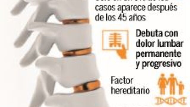 Tabaco y sobrepeso, enemigos de los pacientes con espondiloartritis