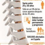 Tabaco y sobrepeso, enemigos de los pacientes con espondiloartritis