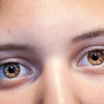 Según Ángela, la madre de Anna, «dependiendo del día y de cómo la mires, Anna tiene un color u otro de ojos. Son únicos».