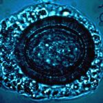 Imagen microscópica de una tenia