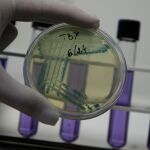 Muestras de la bacteria E. coli extraídas de un alimento