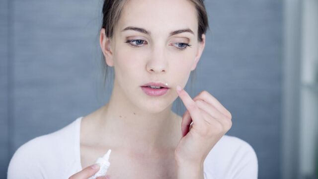 Qué es el herpes labial y cómo tratarlo Qué es el herpes labial y cómo tratarlo