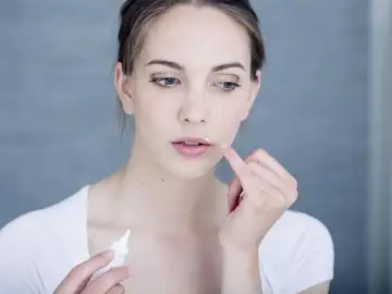 Este virus se asocia principalmente a las lesiones en los labios conocidas como “calenturas” Este virus se asocia principalmente a las lesiones en los labios conocidas como “calenturas”