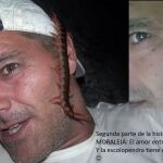 Frank de la jungla tras la mordedura