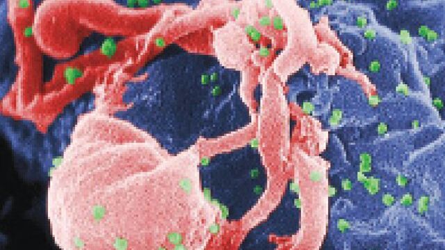 El virus del sida