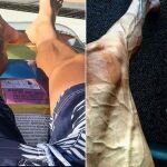 No parecen las piernas de la misma persona, ni siquiera las mismas piernas. Pero lo son.