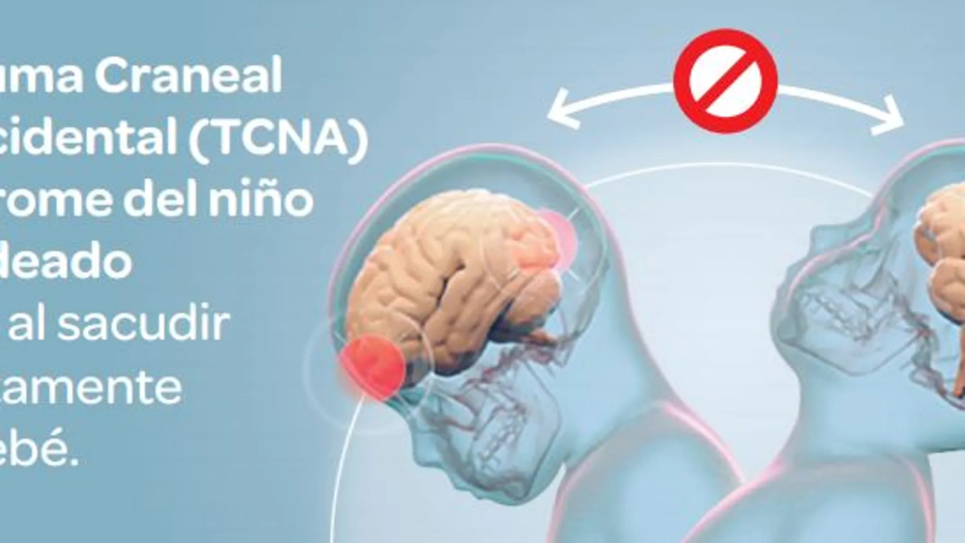 El cerebro del bebé no llena la cavida craneal por lo que al zarandearlo se golpea contra la parte delantera y trasera del cráneo y puede provocar graves lesiones, incluso la muerte