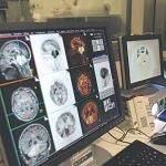 La Medicina permite envejecer con calidad de vida a los pacientes con párkinson