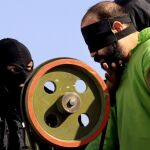 Imagen de archivo de la amputación de los dedos a un condenado por robo según la ley islámica