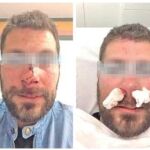 El agente sufrió graves lesiones en todo el cuerpo, especialmente en el rostro