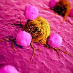 Células cancerosas / Foto: Dreamstime