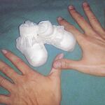 El cáncer de mama en España se sitúa en índices de supervivencia en el 85,2% a los cinco años