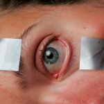 Actualmente, están diagnosticados unos 25.000 casos de narcolepsia en España | Connie G. Santos