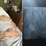 Andy Murray en el hospital