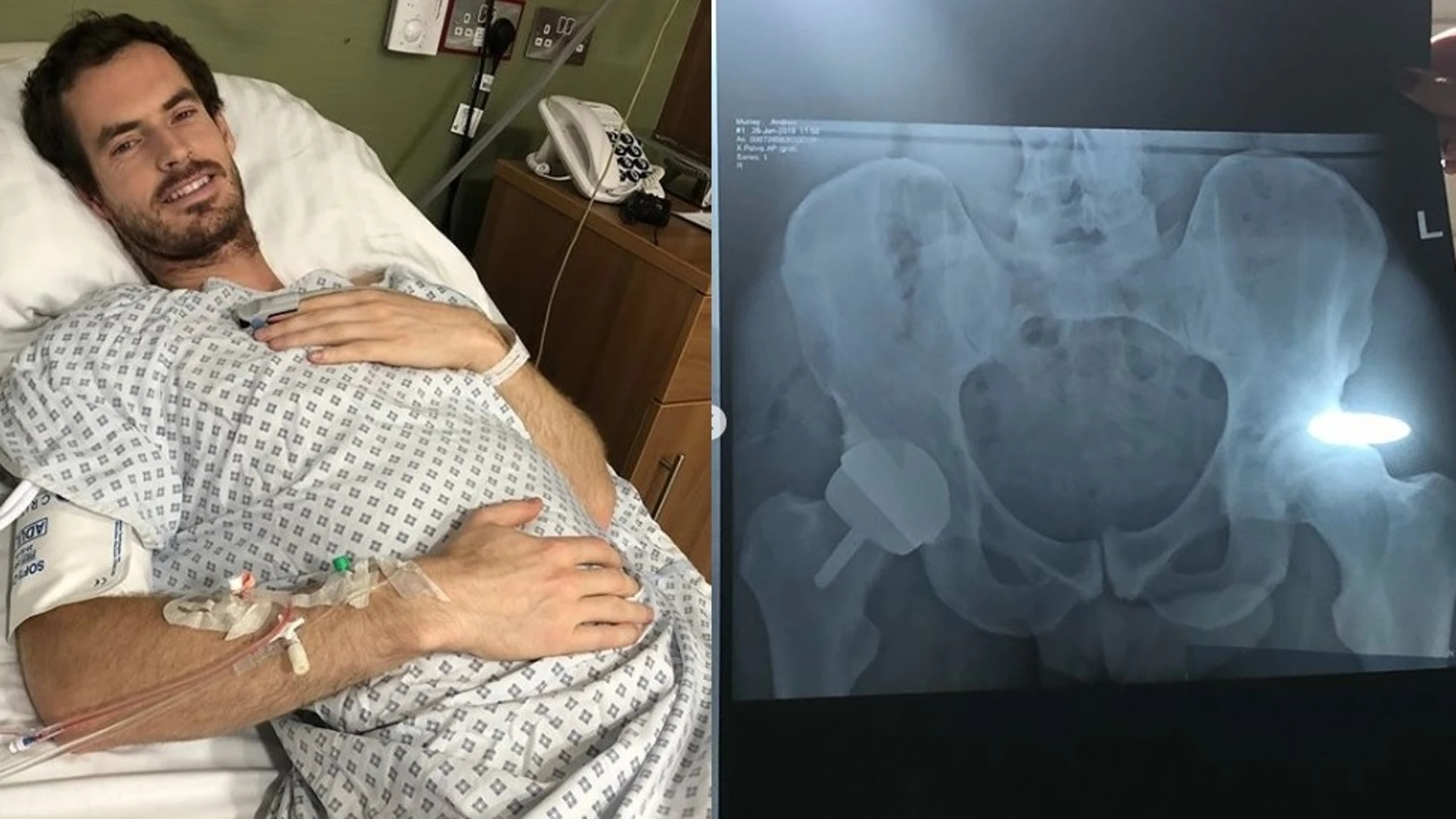 Andy Murray en el hospital
