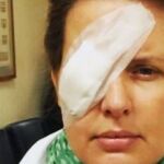 Tania Llasera, herida en un ojo